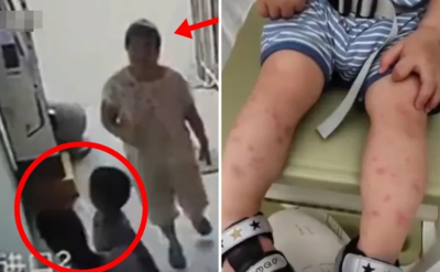1歲童遭鄰居強摟狂親!害高燒確診水痘 媽怒:她孩子剛從醫院回來