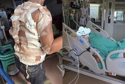 蘭嶼男遭2度潑灑「滾燙熱水」命危搶救！家屬PO文求助