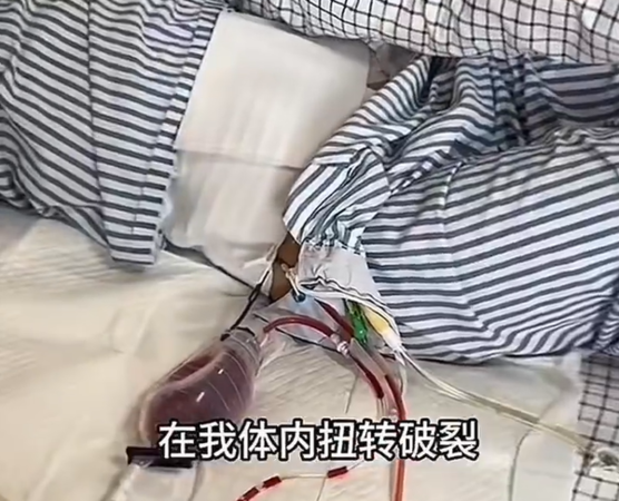 ▲▼25歲網紅經痛十年決定停經。（圖／翻攝自微博）