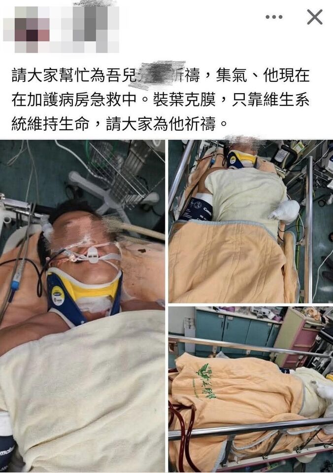 台電員工命危裝葉克膜　爸爸發文請大家幫祈禱