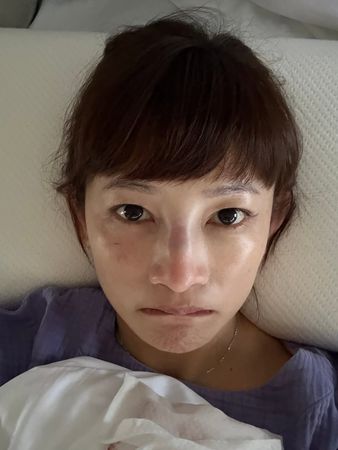 ▲《星光》張涵雅「鼻骨骨折」超慘傷照曝光！　被兒子頭撞：沒想到 。（圖／翻攝自張涵雅IG）