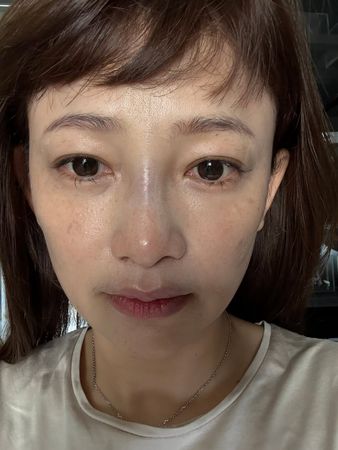 ▲《星光》張涵雅「鼻骨骨折」超慘傷照曝光！　被兒子頭撞：沒想到 。（圖／翻攝自張涵雅IG）