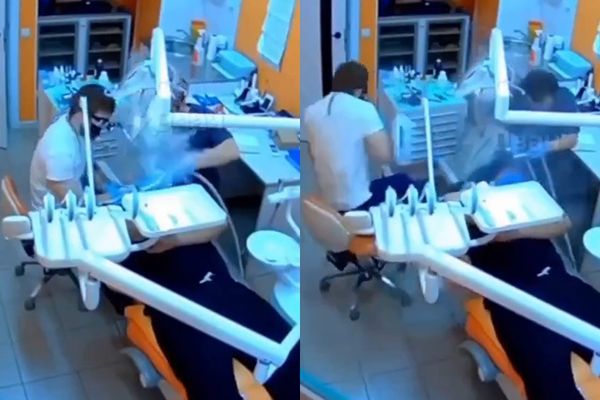 ▲▼潔牙設備「口中爆開」畫面曝　牙醫秒逃走。（圖／翻攝自X）