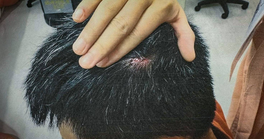 街頭藝人遭玻璃瓶砸頭　分手被逼淨身出戶剩40元