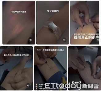 台師大受害女學生每日抽血折磨　還要瘋狂折返跑「泡冰桶」