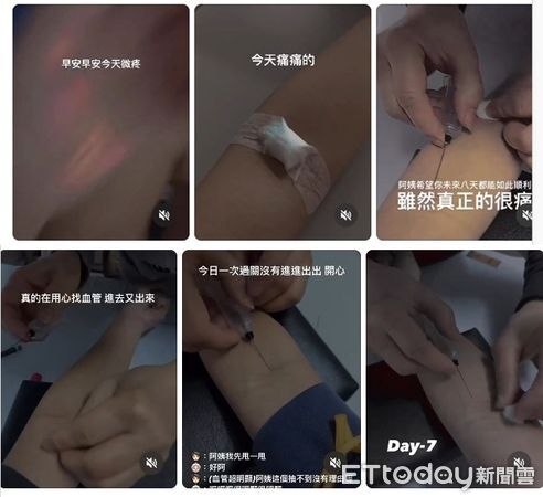 台師大受害女學生每日抽血折磨　還要瘋狂折返跑「泡冰桶」