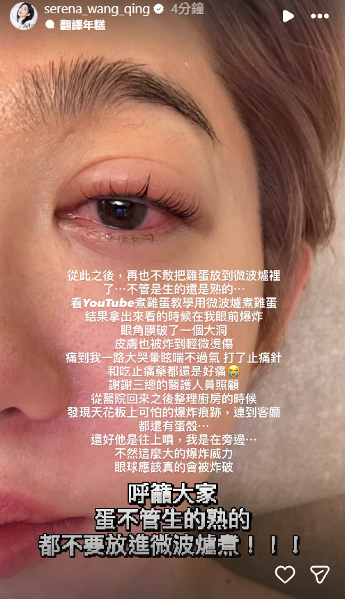 ▲▼王晴微波雞蛋爆炸。（圖／翻攝自Instagram／serena_wang_qing）