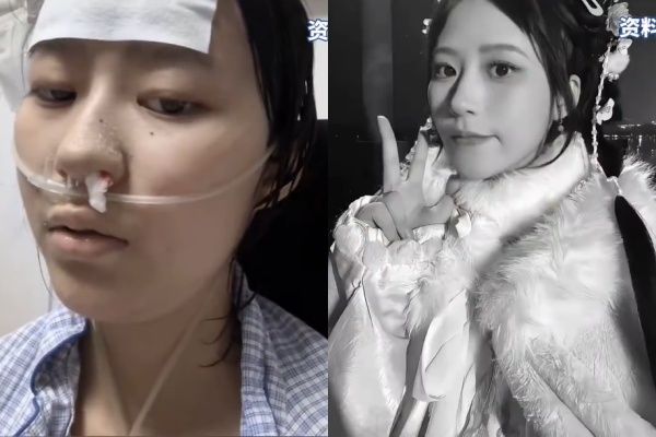 ▲抗癌正妹「呆呆羊」過世。（圖／翻攝自微博）