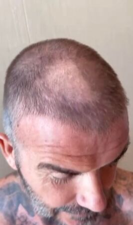 ▲貝克漢剪髮失手「剃禿一大塊」急遮！　老婆大笑：這看起來很糟糕 。（圖／翻攝自貝克漢IG）