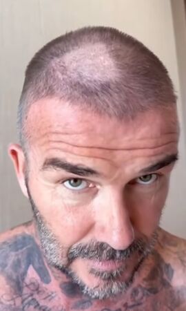 ▲貝克漢剪髮失手「剃禿一大塊」急遮！　老婆大笑：這看起來很糟糕 。（圖／翻攝自貝克漢IG）