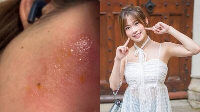 E級女星敷面膜「整臉像十級火災」！　險毀容近照曝光