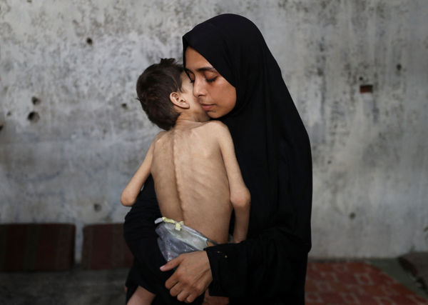 ▲▼加薩走廊成千上萬的巴勒斯坦人面臨大範圍饑荒威脅。（圖／路透）