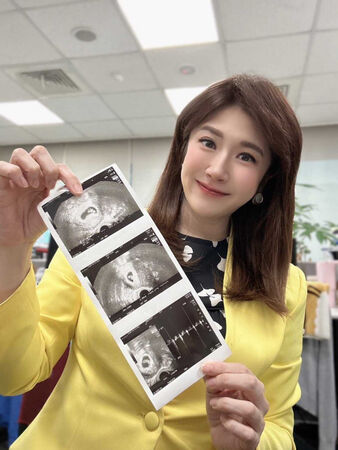 好孕藏不住1／主播鄭亦真甜牽老公夜奔婦產科　「肚皮隆起」洩孕味　