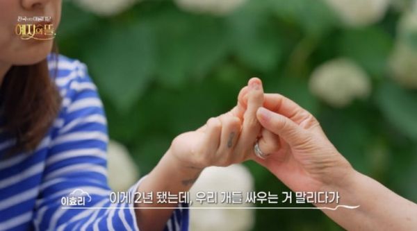 ▲李孝利「左手中指嚴重變形」神經全斷！　2年前阻止狗打架被咬送醫（圖／翻攝自韓網）