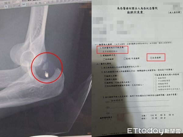 ▲▼國軍班長在演練奪刀術，竟然將士兵硬摔，導致手肘骨折錯位，家屬控「因公受傷，為什麼還要補假」。（圖／記者邱中岳翻攝）