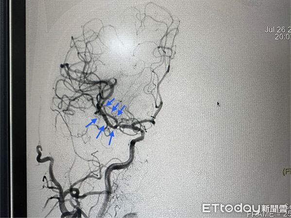 ▲警官體育館運動突倒地，消防醫護聯手救命成功。（圖／衛福部南投醫院提供）