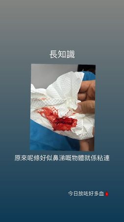 ▲李幸倪身體出狀況，曬出拔罐放血的照片，相當怵目驚心。（圖／翻攝自李幸倪Instagram）