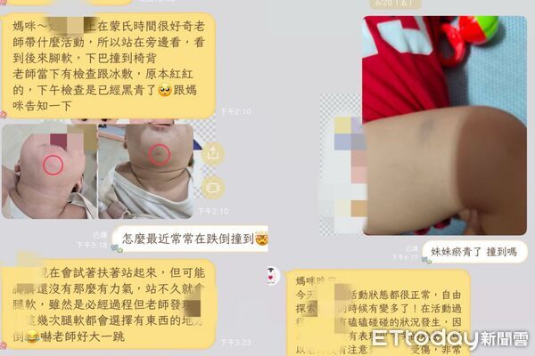 ▲▼托嬰糾紛！1歲童身上瘀青、咬痕不斷　下月不讀了仍被索近萬學費。（圖／家長提供）
