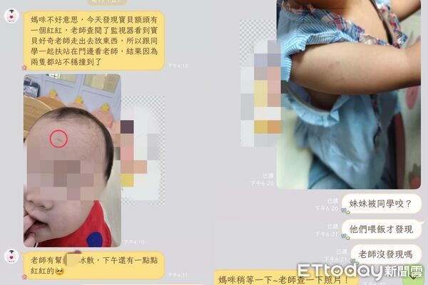 ▲▼托嬰糾紛！1歲童身上瘀青、咬痕不斷　下月不讀了仍被索近萬學費。（圖／家長提供）