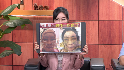 罹大腸癌末期！　顧婕再動刀拉皮6小時「驚悚手術照曝光」：我不能老