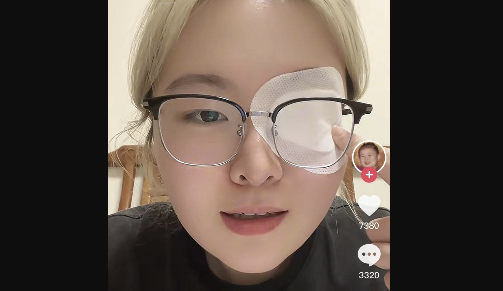 ▲大陸前童星吳煜輝患「美女病」右眼失明。（圖／翻攝微博）