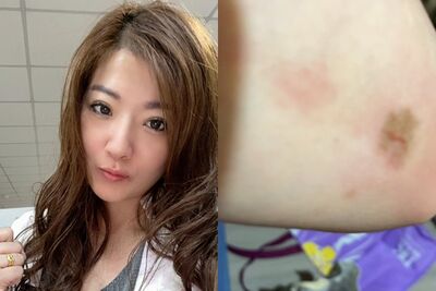 侯沁潔不認刻意撞警察！「我的傷更嚴重」怒嗆員警：做賊喊抓賊