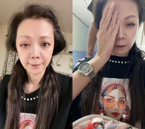 ▲▼高欣欣誤用傷口藥水點眼睛！急奔醫院曝現況。（圖／翻攝自Facebook／高欣欣 欣想事成俱樂部）