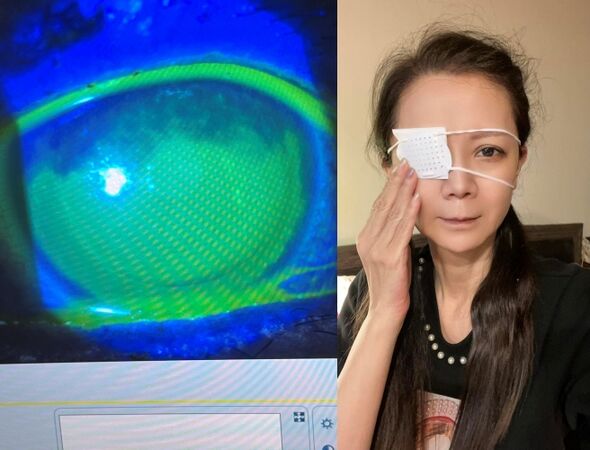 ▲▼高欣欣誤用傷口藥水點眼睛！急奔醫院曝現況。（圖／翻攝自Facebook／高欣欣 欣想事成俱樂部）