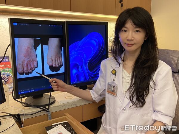 ▲茂盛醫院,香港腳,鍾佩宜。（圖／記者游瓊華攝）