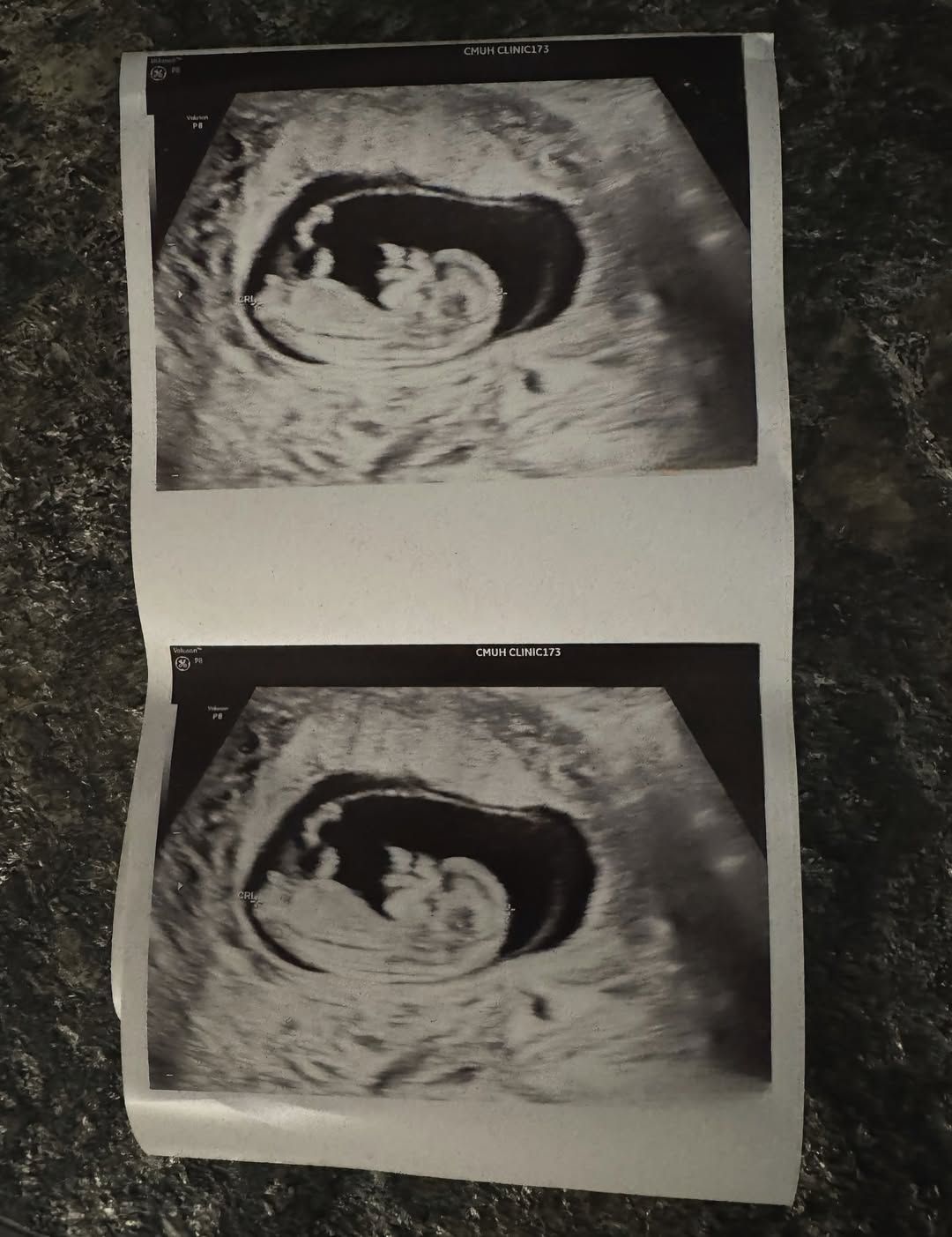 ▲▼高爾宣當爸未滿1年再報喜！興奮喊：孝子來一枚。（圖／翻攝自Instagram／redhung10）