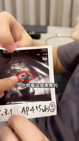 ▲若綺40歲宣布懷孕哭了！　「2年前突然想生」：原本狀況不是太理想。（圖／翻攝自若綺IG）