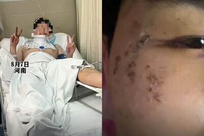 夢到被人追趕！20歲男開窗逃生「醒來人在半空」　3樓墜落摔成重傷