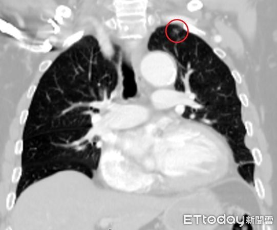 ▲光田醫院,胸腔外科醫師陳紀寰。（圖／光田醫院提供）