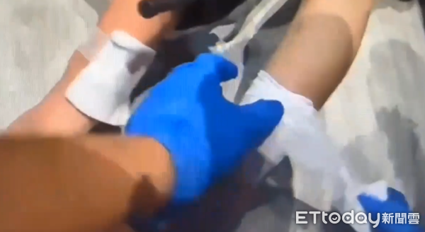▲▼             基隆5歲童在大樓社區遊戲室，被毒蛇龜殼花咬傷。（圖／記者郭世賢翻攝，下同）