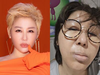 藍心湄突長「臭嘴角」洩身體警訊！　素顏照網急：快去看醫生