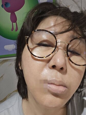 ▲▼藍心湄突長「臭嘴角」洩身體警訊。（圖／翻攝自臉書／藍心湄）