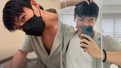 33歲金馬男星罹肺腺癌四期「近況曝光」! 把進醫院當作去遊樂場