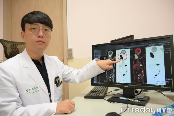 ▲淋巴癌,亞大附醫,賴彥廷,血液腫瘤科。（圖／亞大醫院提供）