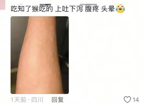 ▲▼  大陸男子吃蟬蛹眼睛腫           。（圖／翻攝 封面新聞、百度）