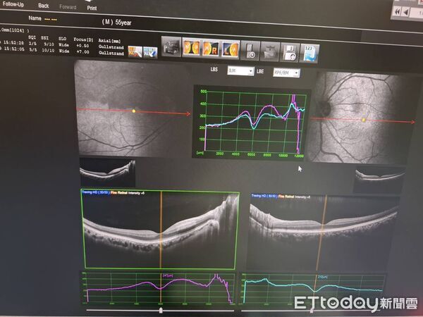 ▲秦楊。（圖／ETtoday）