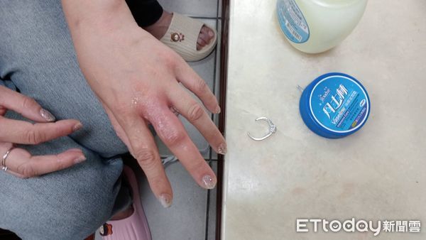 ▲枋寮消防分隊利用工具取下戒指。（圖／枋寮消防分隊提供）