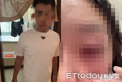 中和24歲女拒絕復合遭狂揍！眼球破裂傷視力　恐怖前任3萬交保
