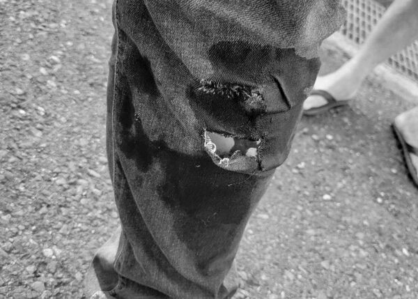 ▲▼洪騰明議員為了猛犬咬人肉身阻擋遭咬傷送醫。（圖／洪騰明提供）