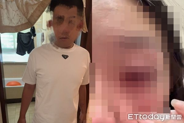 ▲▼             24歲女子拒絕前任要求復合，遭對方揍到水晶體破裂。（圖／記者陸運陞翻攝，下同）