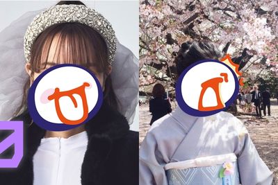 櫻花妹整形中毒「動刀28次」!14歲就割雙眼皮 超進化長相曝