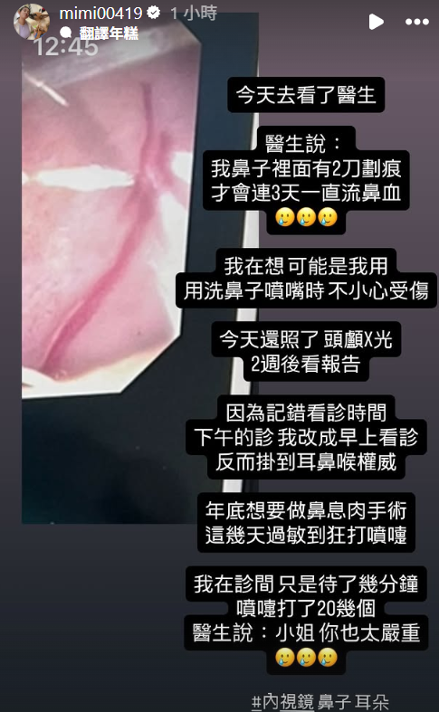 ▲▼米可白。（圖／翻攝自Instagram／mimi00419）