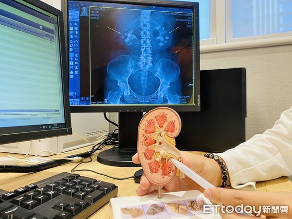 ▲▼博田國際醫院泌尿科醫師王建勝。（圖／記者許宥孺翻攝）