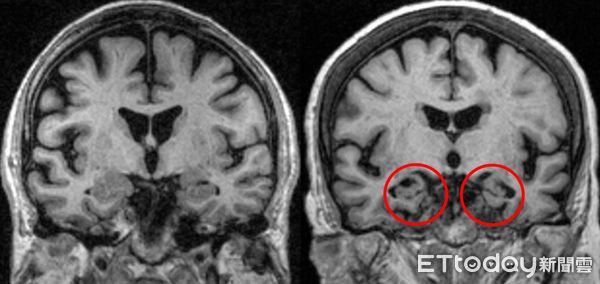 ▲陳廷斌,神經內科,失智,光田。（圖／光田醫院提供）