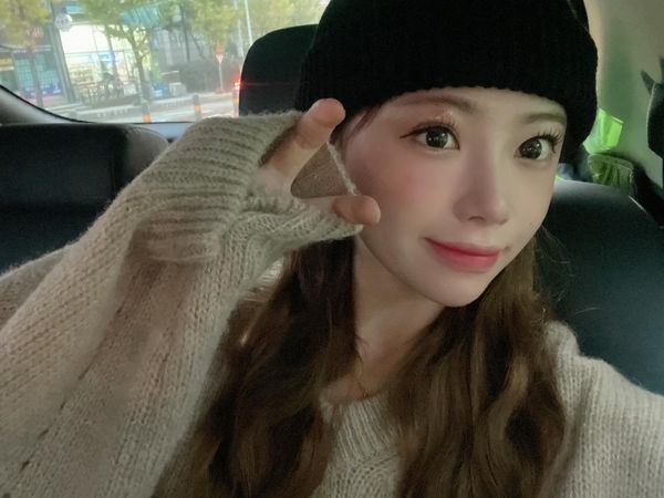 ▲金娜妍眼睛周圍長帶狀皰疹。（圖／翻攝自金娜妍Threads）