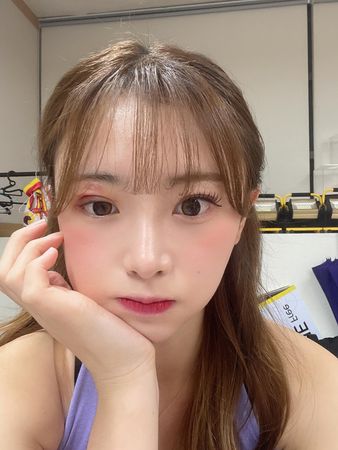 ▲金娜妍眼睛周圍長帶狀皰疹。（圖／翻攝自金娜妍Threads）